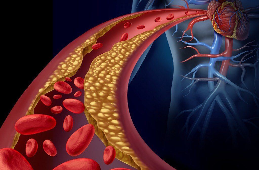 Enfermedades Cardiovasculares